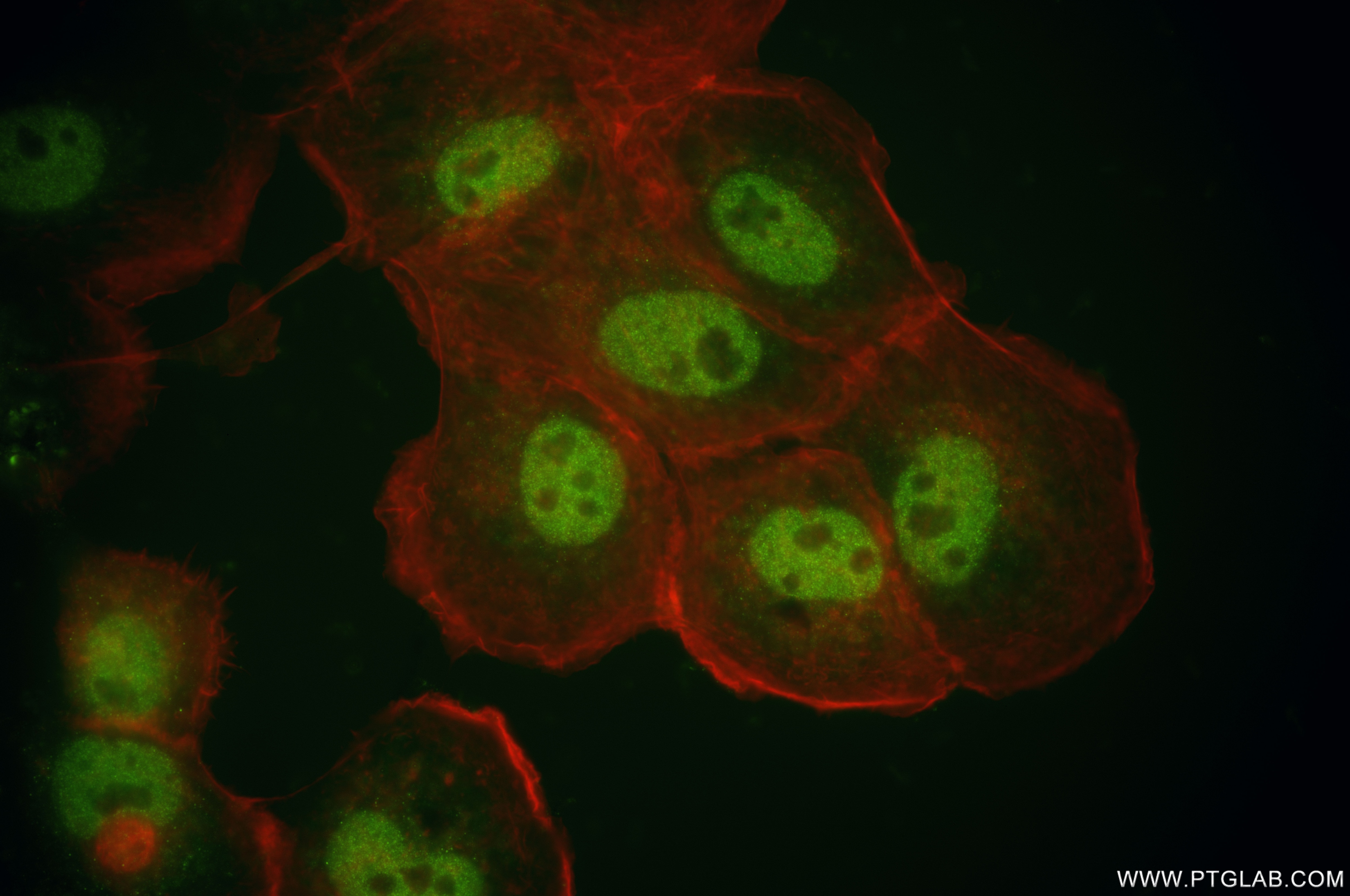 Immunofluorescence (IF) / fluorescent staining of A431 cells using SNAI2/SLUG Recombinant antibody (82755-3-RR)