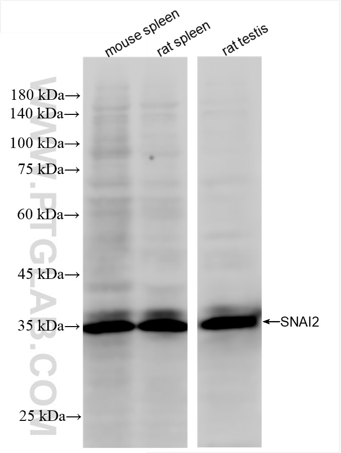 SNAI2/SLUG