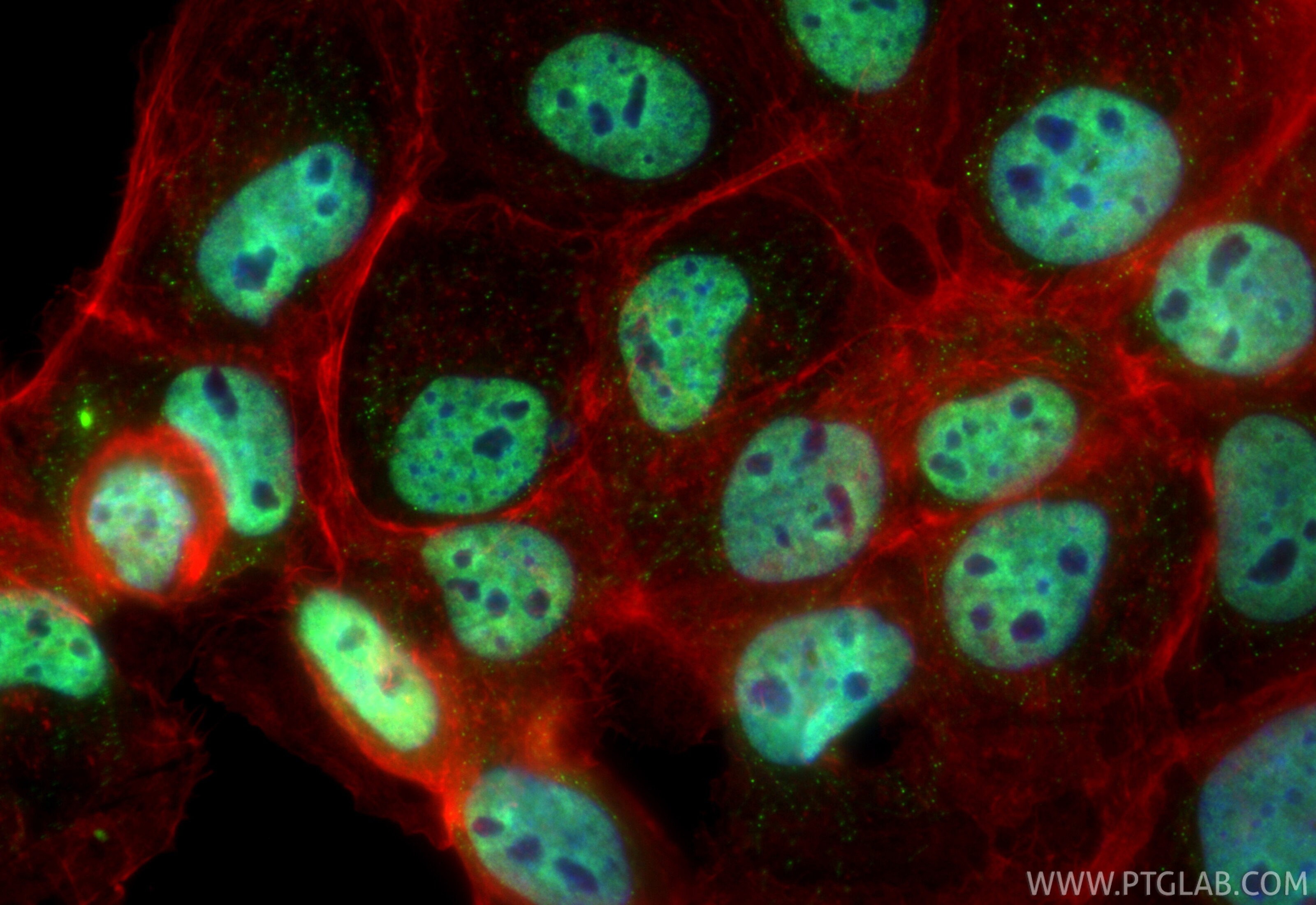Immunofluorescence (IF) / fluorescent staining of A431 cells using CoraLite® Plus 488-conjugated SNAI2/SLUG Recombina (CL488-82755-3)