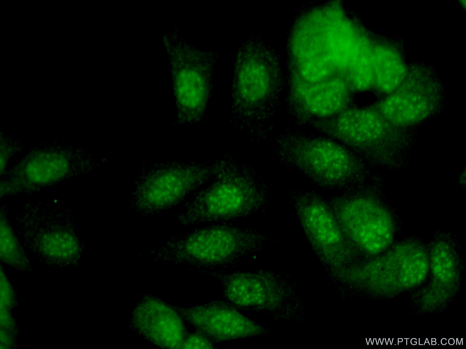 Immunofluorescence (IF) / fluorescent staining of MCF-7 cells using SNAI3 Polyclonal antibody (21350-1-AP)