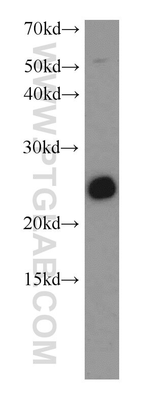 SNAP25 Polyclonal antibody