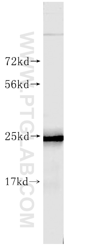 Western Blot (WB) analysis of mouse brain tissue using SNAP25 Polyclonal antibody (10007-1-AP)