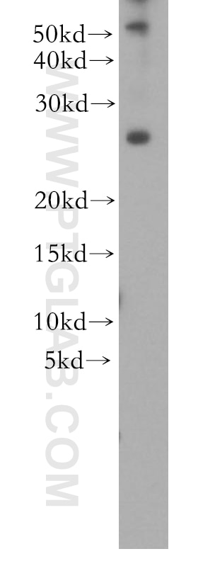 Western Blot (WB) analysis of mouse brain tissue using SNAP25 Polyclonal antibody (10007-1-AP)