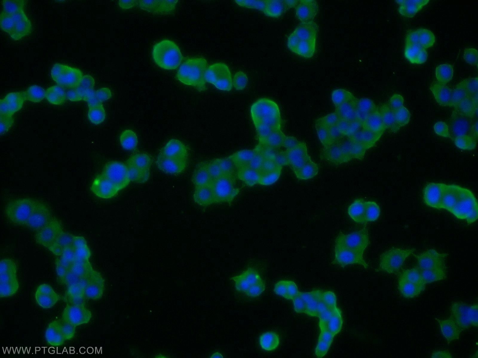 Immunofluorescence (IF) / fluorescent staining of PC-12 cells using SNAP25 Polyclonal antibody (14903-1-AP)