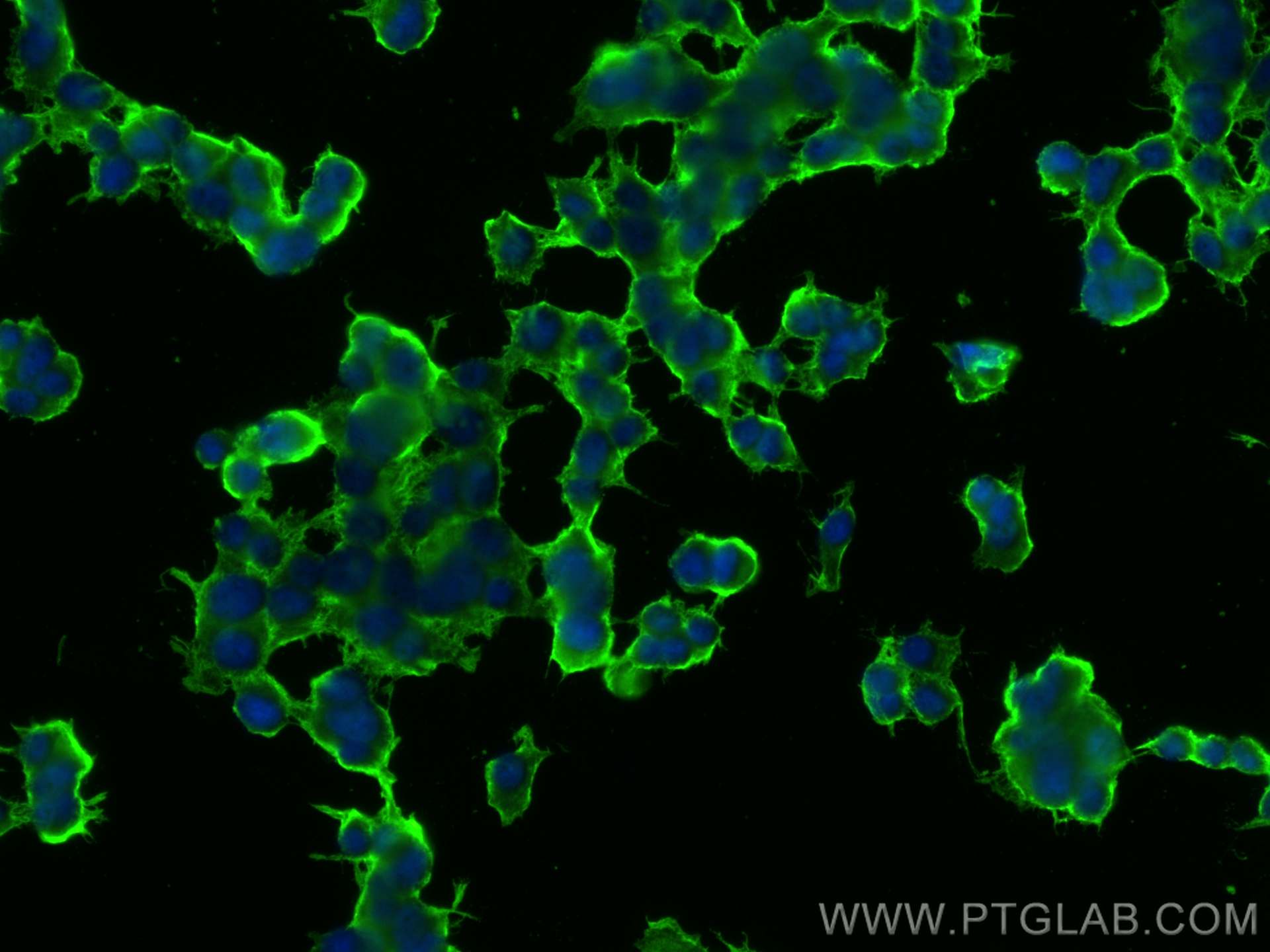 Immunofluorescence (IF) / fluorescent staining of PC-12 cells using SNAP25 Polyclonal antibody (14903-1-AP)