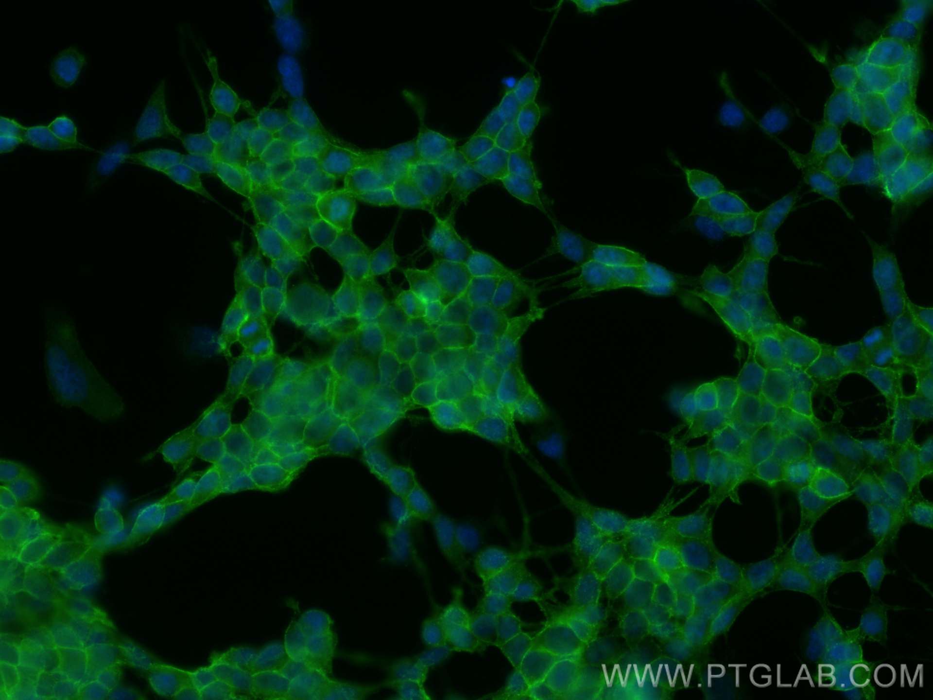 Immunofluorescence (IF) / fluorescent staining of SH-SY5Y cells using SNAP25 Polyclonal antibody (14903-1-AP)