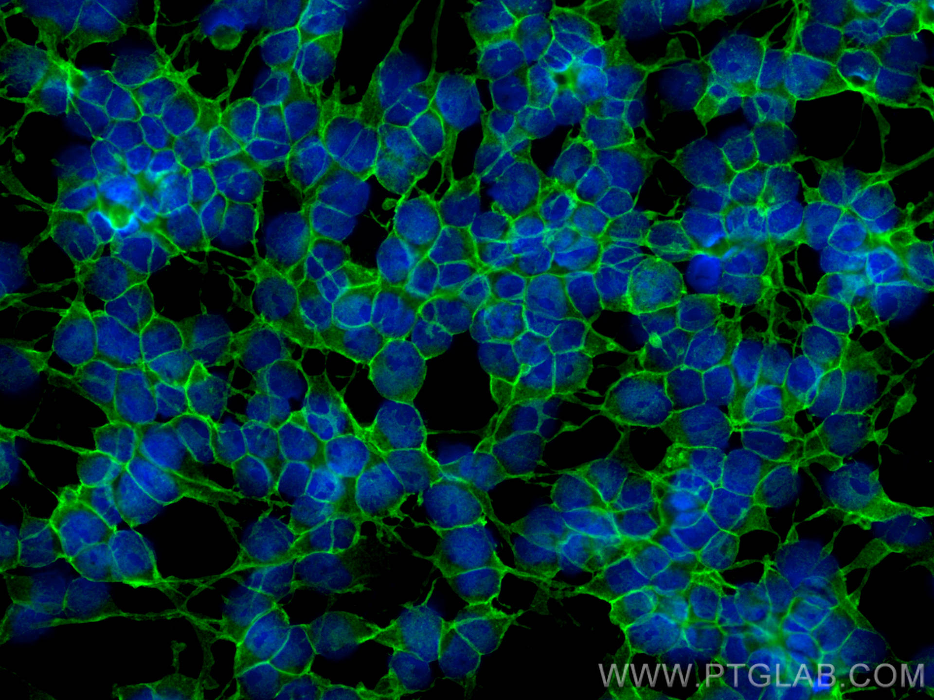 Immunofluorescence (IF) / fluorescent staining of SH-SY5Y cells using SNAP25 Polyclonal antibody (14903-1-AP)