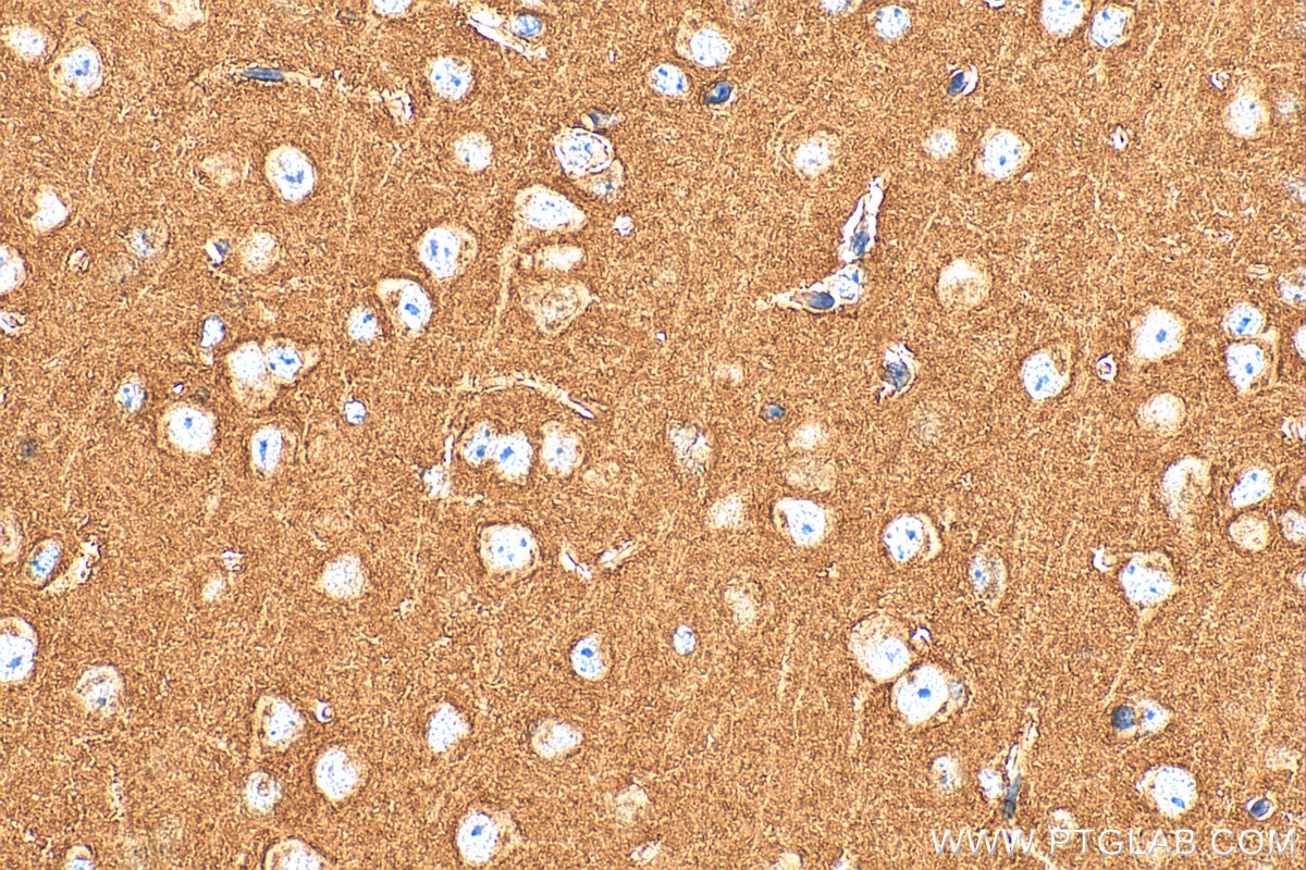 Immunohistochemical analysis of paraffin-embedded mouse brain tissue slide using 14903-1-AP (SNAP25 antibody) at dilution of 1:1000 (under 40x lens). Heat mediated antigen retrieval with Tris-EDTA buffer (pH 9.0). This data was developed using the same antibody clone with 14903-1-PBS in a different storage buffer formulation. Immunohistochemistry (IHC) staining of mouse brain tissue using SNAP25 Polyclonal antibody (14903-1-AP)