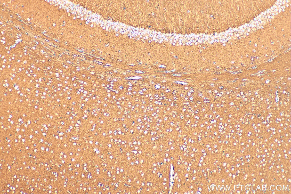 Immunohistochemical analysis of paraffin-embedded mouse brain tissue slide using 14903-1-AP (SNAP25 antibody) at dilution of 1:1000 (under 10x lens). Heat mediated antigen retrieval with Tris-EDTA buffer (pH 9.0). This data was developed using the same antibody clone with 14903-1-PBS in a different storage buffer formulation. Immunohistochemistry (IHC) staining of mouse brain tissue using SNAP25 Polyclonal antibody (14903-1-AP)