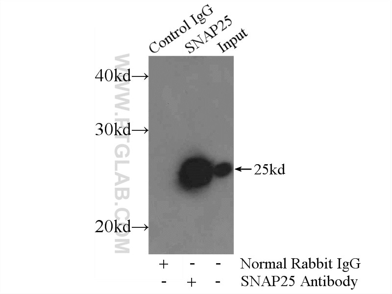 Immunoprecipitation (IP) experiment of mouse brain tissue using SNAP25 Polyclonal antibody (14903-1-AP)