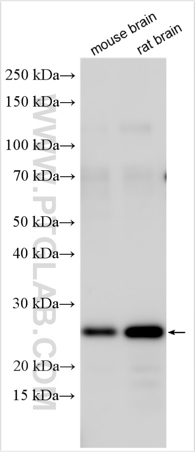 Western Blot (WB) analysis of various lysates using SNAP25 Polyclonal antibody (14903-1-AP)
