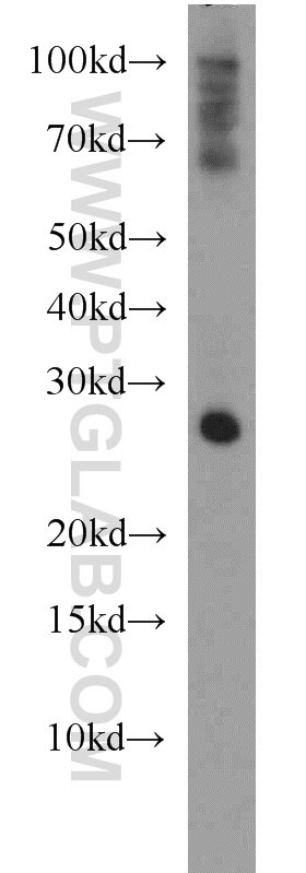 SNAP25 Polyclonal antibody