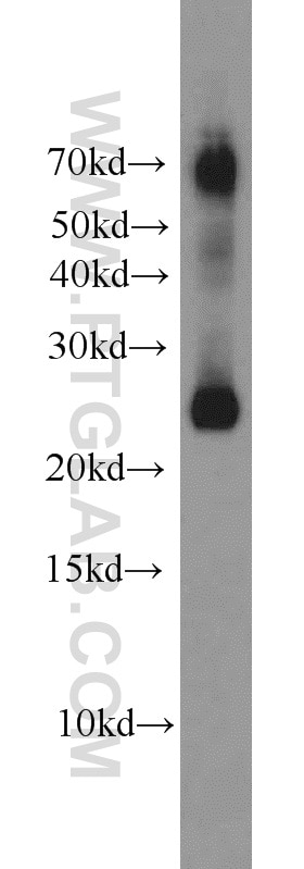 Western Blot (WB) analysis of rat brain tissue using SNAP25 Polyclonal antibody (14903-1-AP)