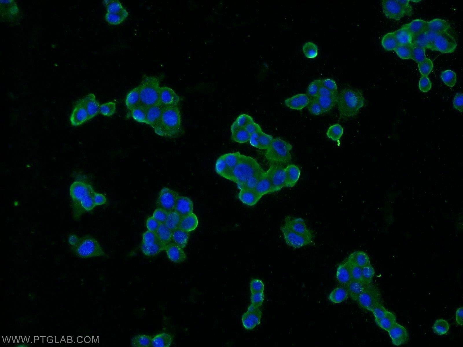 SNAP25 Monoclonal antibody