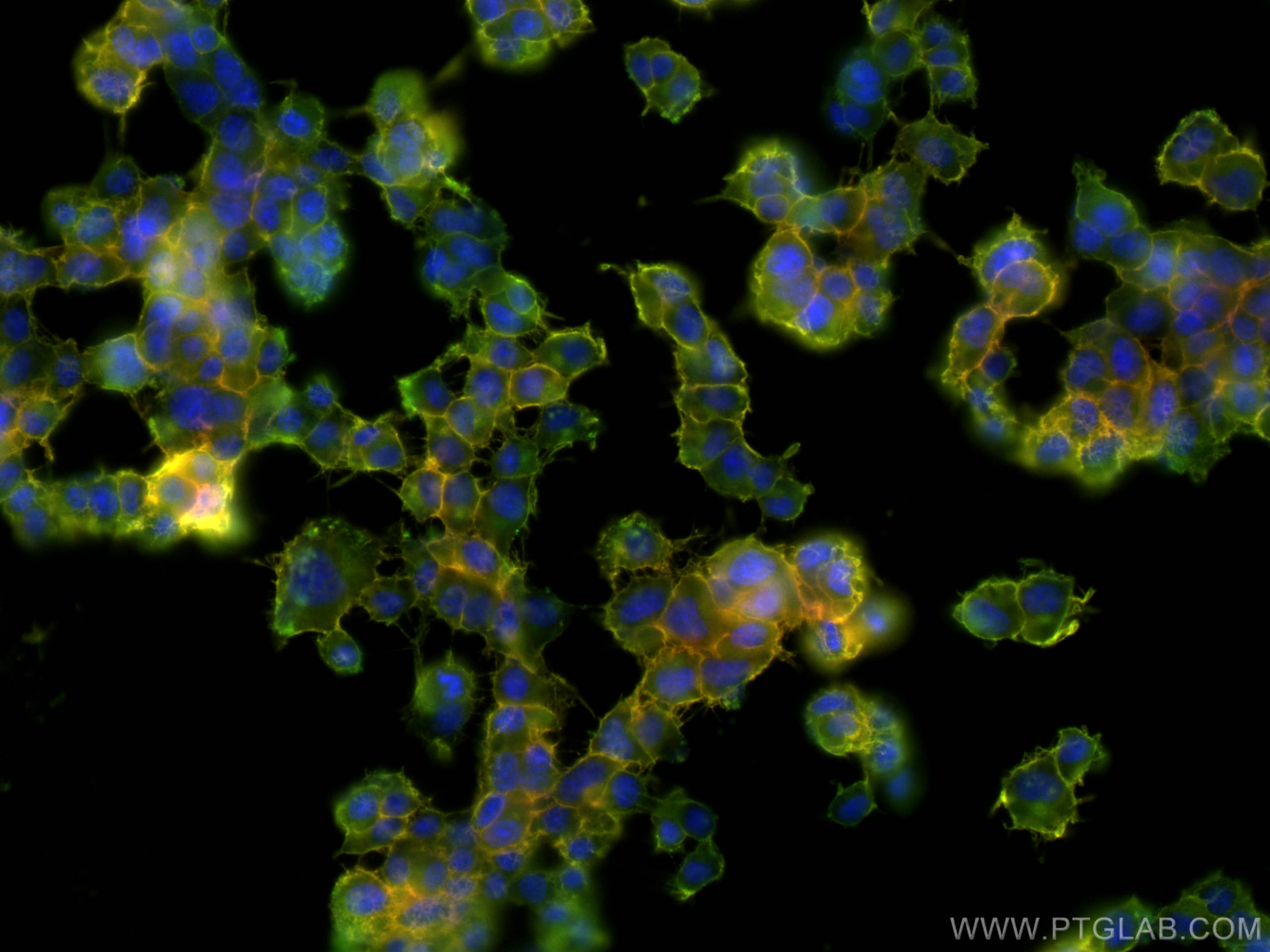 Immunofluorescence (IF) / fluorescent staining of PC-12 cells using SNAP25 Monoclonal antibody (60159-1-Ig)