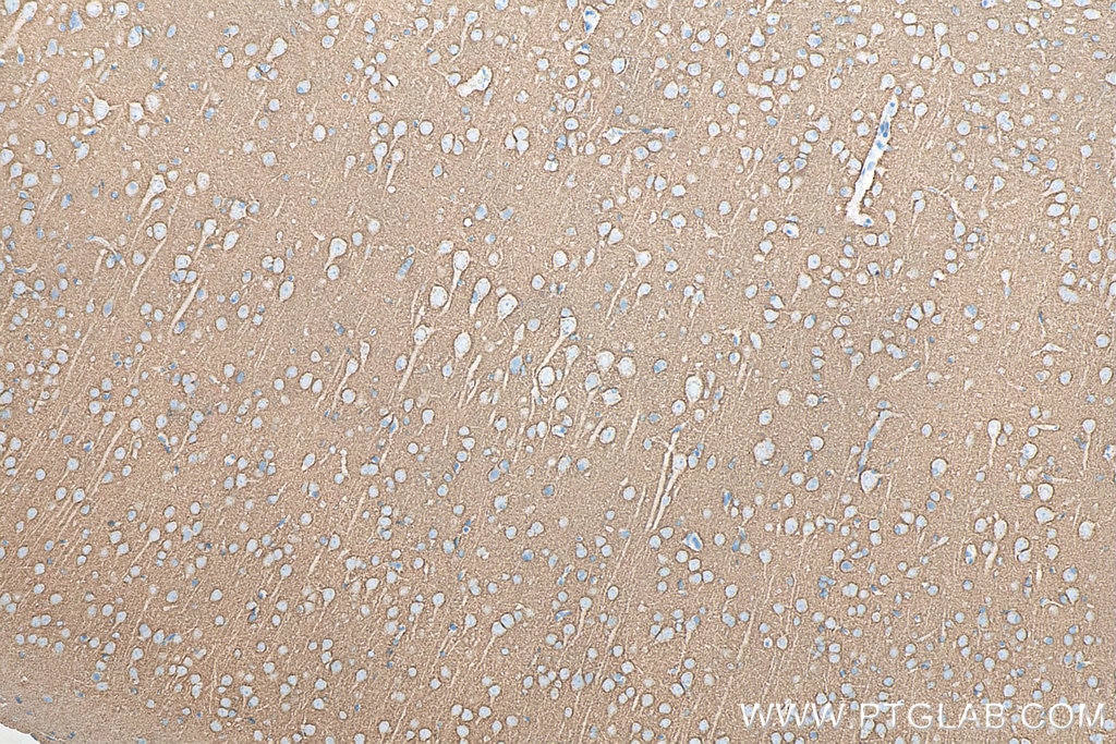 Immunohistochemistry (IHC) staining of rat brain tissue using SNAP25 Monoclonal antibody (60159-1-Ig)