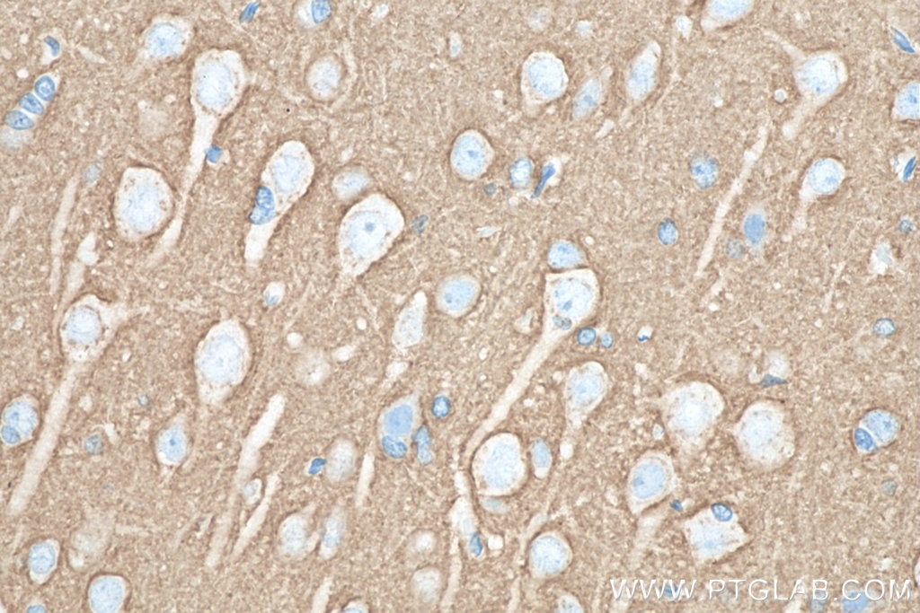 Immunohistochemistry (IHC) staining of rat brain tissue using SNAP25 Monoclonal antibody (60159-1-Ig)