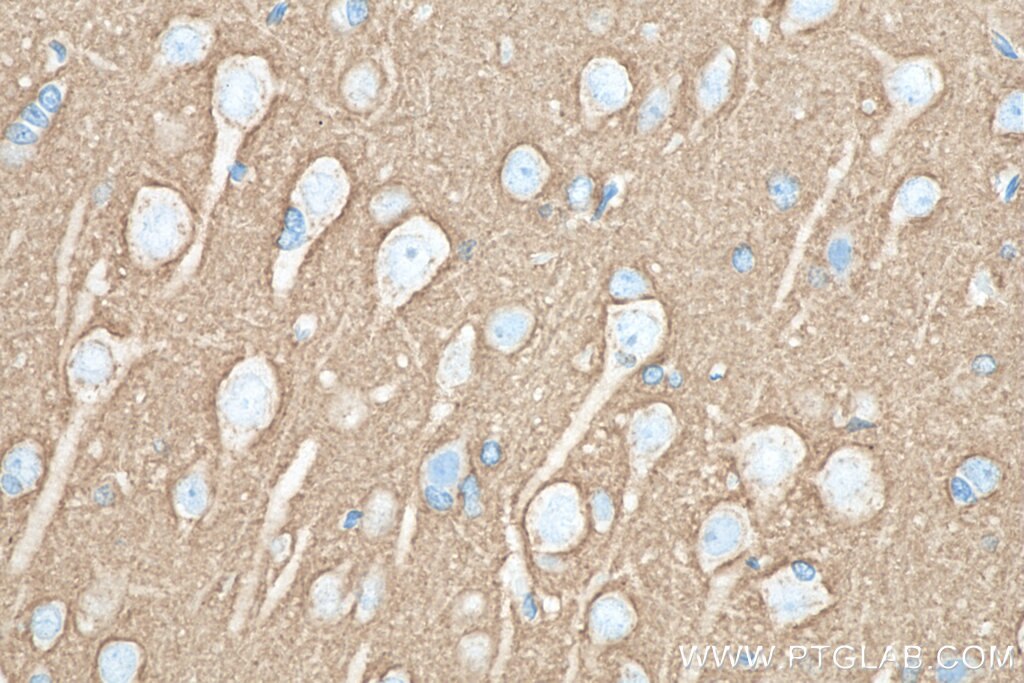 Immunohistochemistry (IHC) staining of rat brain tissue using SNAP25 Monoclonal antibody (60159-1-Ig)