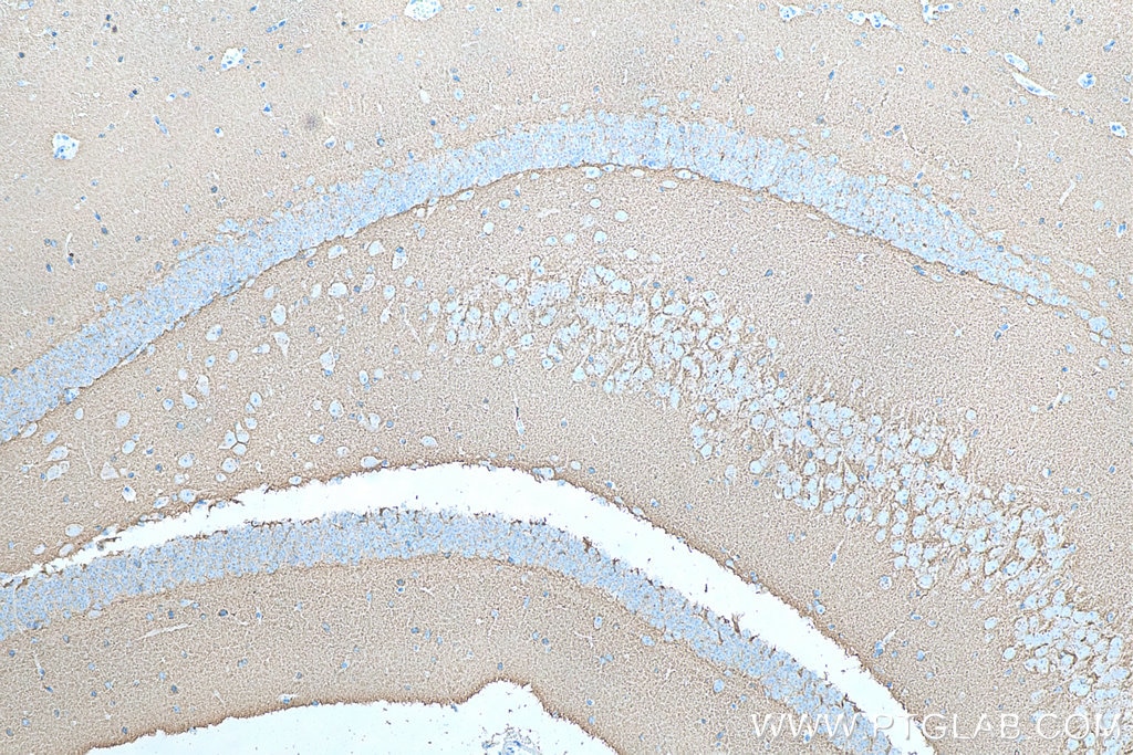 IHC staining of mouse brain using 60159-1-Ig
