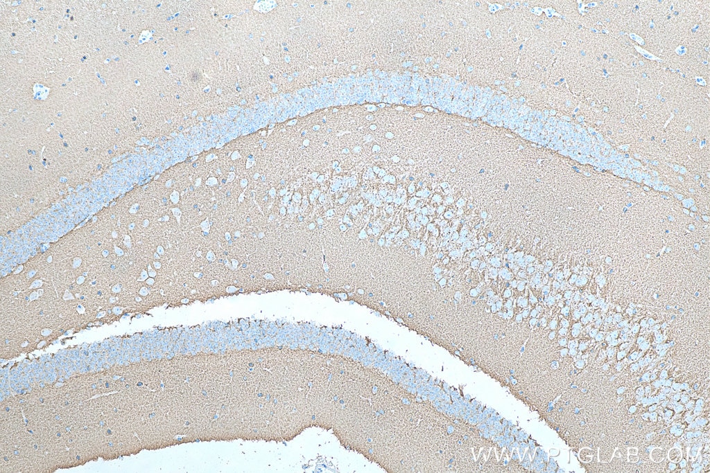 Immunohistochemistry (IHC) staining of mouse brain tissue using SNAP25 Monoclonal antibody (60159-1-Ig)