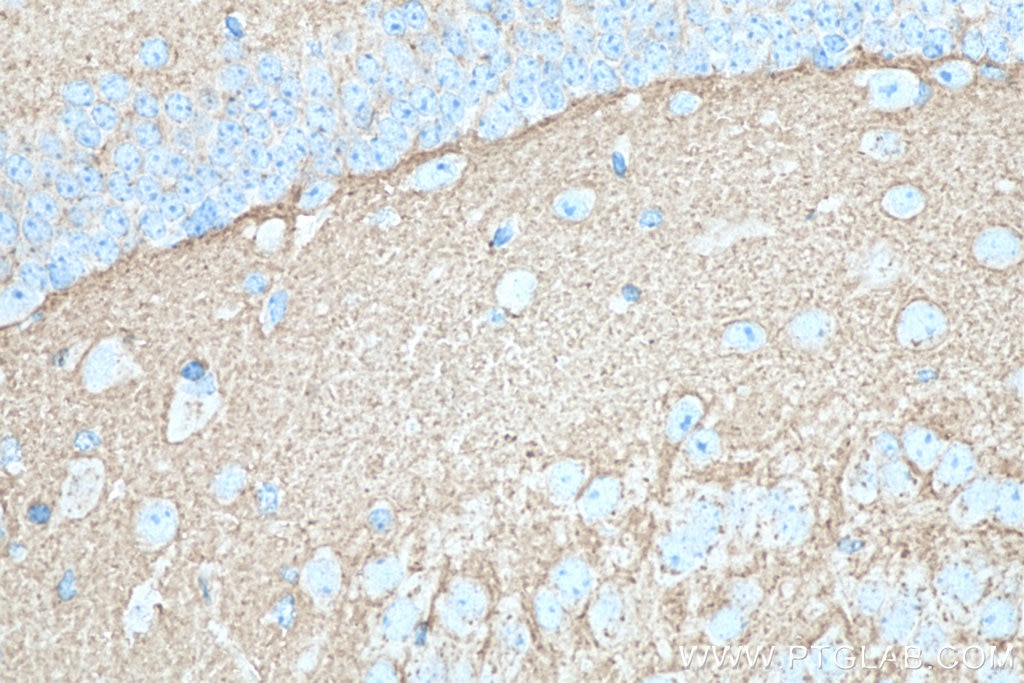 Immunohistochemistry (IHC) staining of mouse brain tissue using SNAP25 Monoclonal antibody (60159-1-Ig)