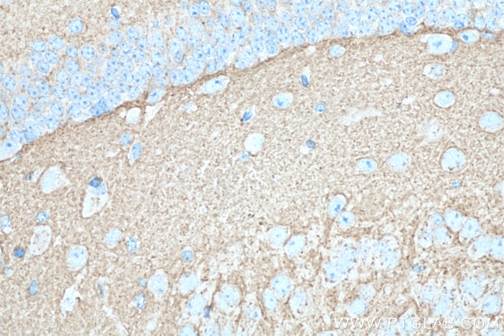 Immunohistochemistry (IHC) staining of mouse brain tissue using SNAP25 Monoclonal antibody (60159-1-Ig)