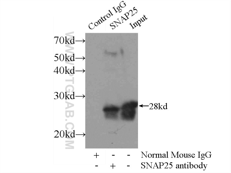 Immunoprecipitation (IP) experiment of mouse brain tissue using SNAP25 Monoclonal antibody (60159-1-Ig)