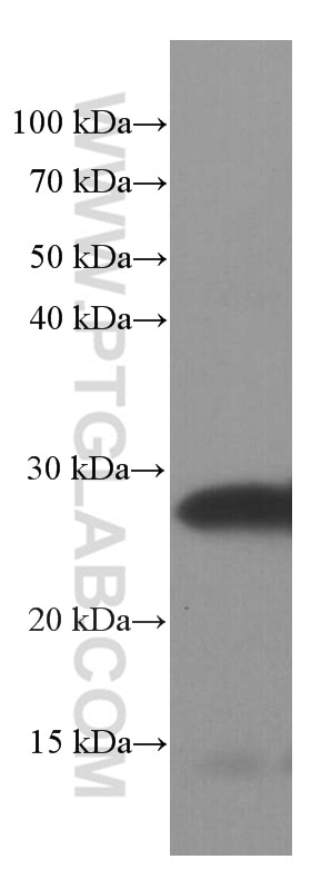 Western Blot (WB) analysis of pig brain tissue using SNAP25 Monoclonal antibody (60159-1-Ig)