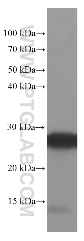 Western Blot (WB) analysis of rat brain tissue using SNAP25 Monoclonal antibody (60159-1-Ig)