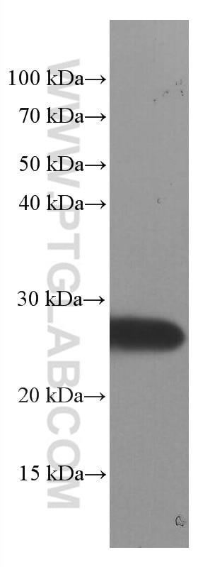 Western Blot (WB) analysis of mouse brain tissue using SNAP25 Monoclonal antibody (60159-1-Ig)