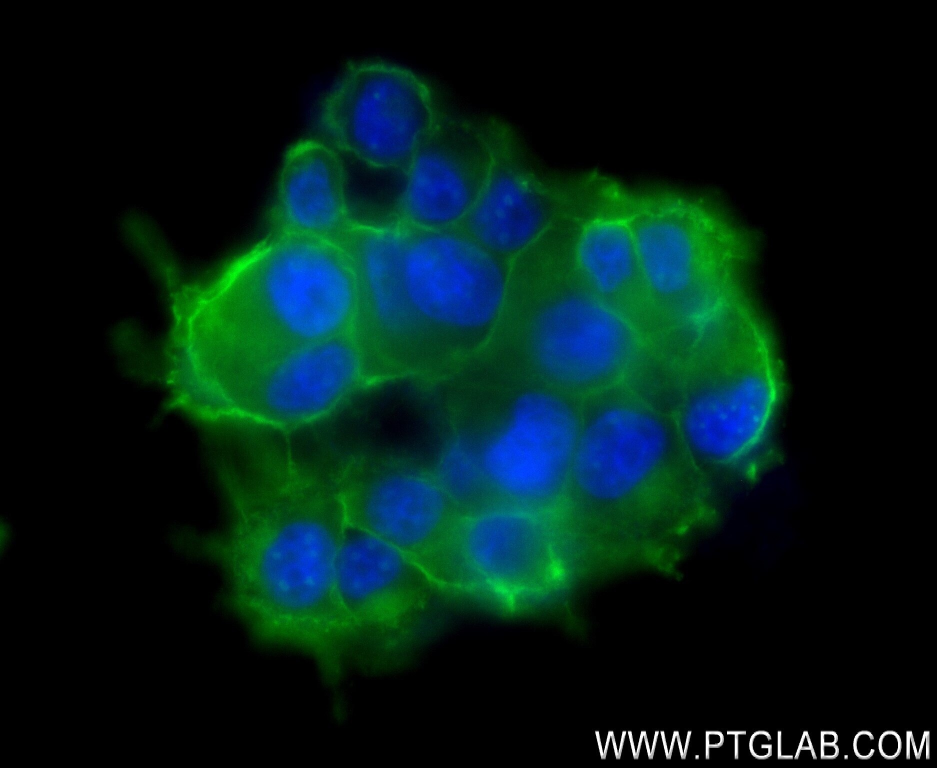 Immunofluorescence (IF) / fluorescent staining of PC-12 cells using SNAP25 Recombinant antibody (83259-1-RR)