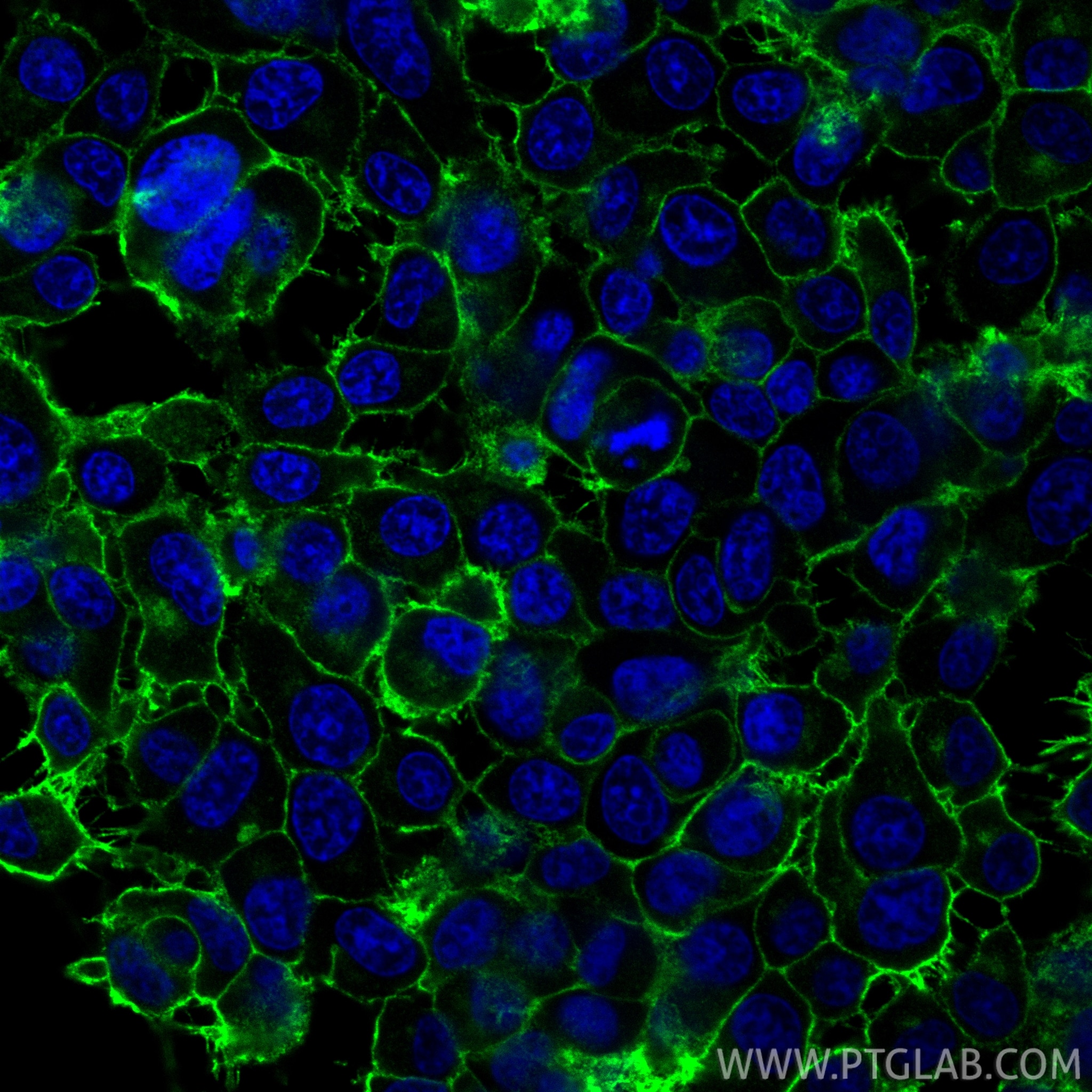 Immunofluorescence (IF) / fluorescent staining of PC-12 cells using SNAP25 Recombinant monoclonal antibody (83259-1-RR)
