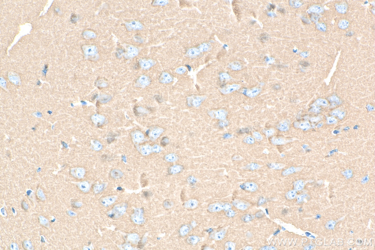 Immunohistochemistry (IHC) staining of mouse brain tissue using SNAP25 Recombinant antibody (83259-1-RR)
