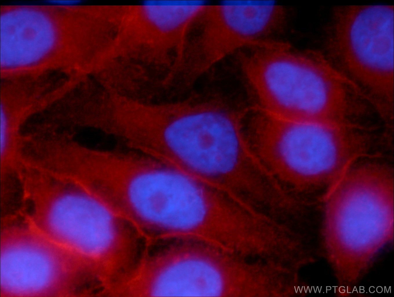 Immunofluorescence (IF) / fluorescent staining of HepG2 cells using SNAP23 Polyclonal antibody (10825-1-AP)