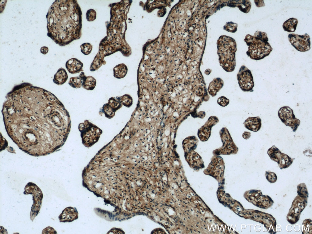 IHC staining of human placenta using 10825-1-AP