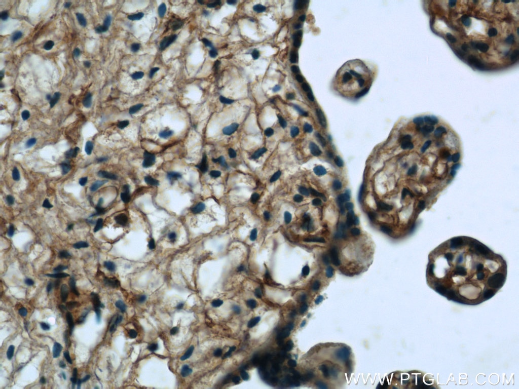 Immunohistochemistry (IHC) staining of human placenta tissue using SNAP23 Polyclonal antibody (10825-1-AP)