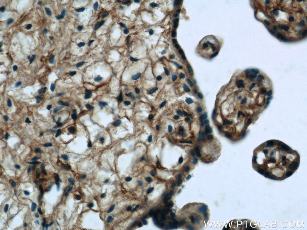 IHC staining of human placenta using 10825-1-AP