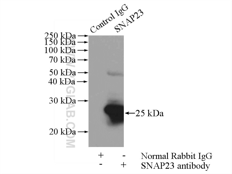 Immunoprecipitation (IP) experiment of HeLa cells using SNAP23 Polyclonal antibody (10825-1-AP)