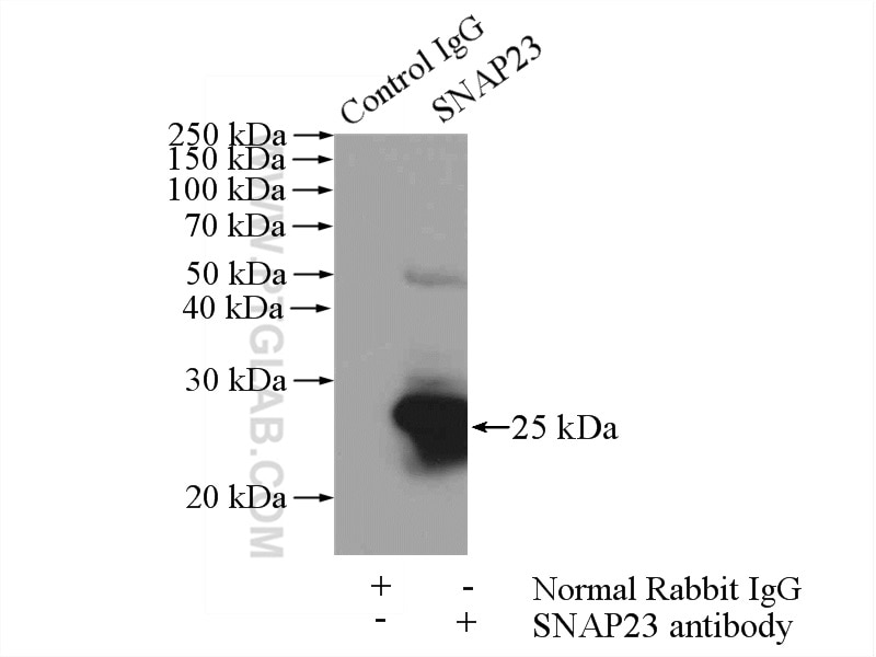 IP experiment of HeLa using 10825-1-AP