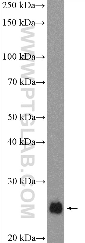 Western Blot (WB) analysis of HeLa cells using SNAP23 Polyclonal antibody (10825-1-AP)