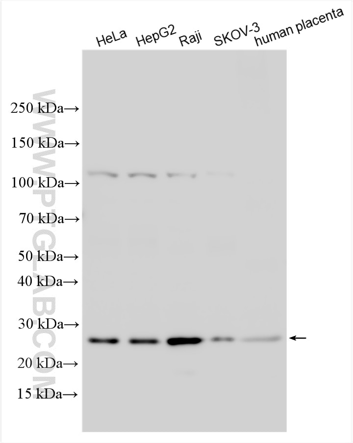 Western Blot (WB) analysis of various lysates using SNAP23 Polyclonal antibody (10825-1-AP)