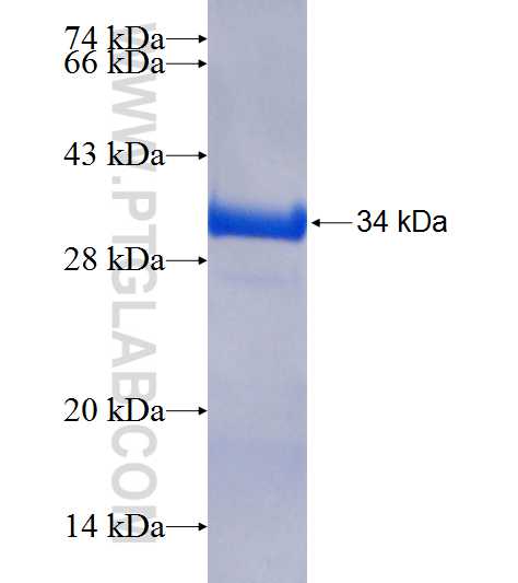 SNAP23 fusion protein Ag21085 SDS-PAGE