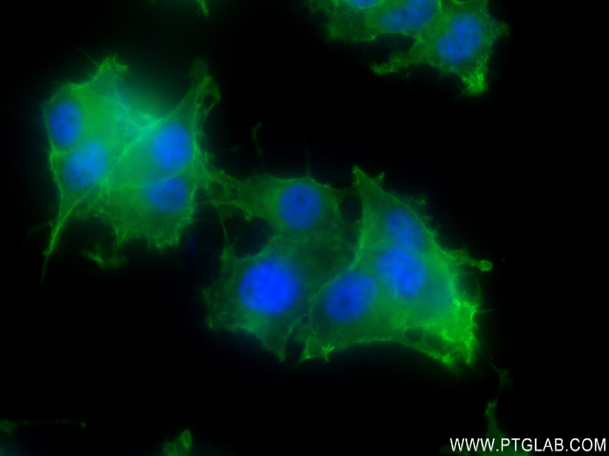 Immunofluorescence (IF) / fluorescent staining of PC-12 cells using SNAP25 Recombinant antibody (83259-5-RR)