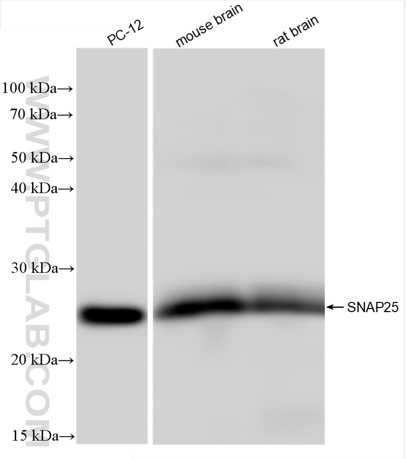 Western Blot (WB) analysis of various lysates using SNAP25 Recombinant antibody (83259-5-RR)