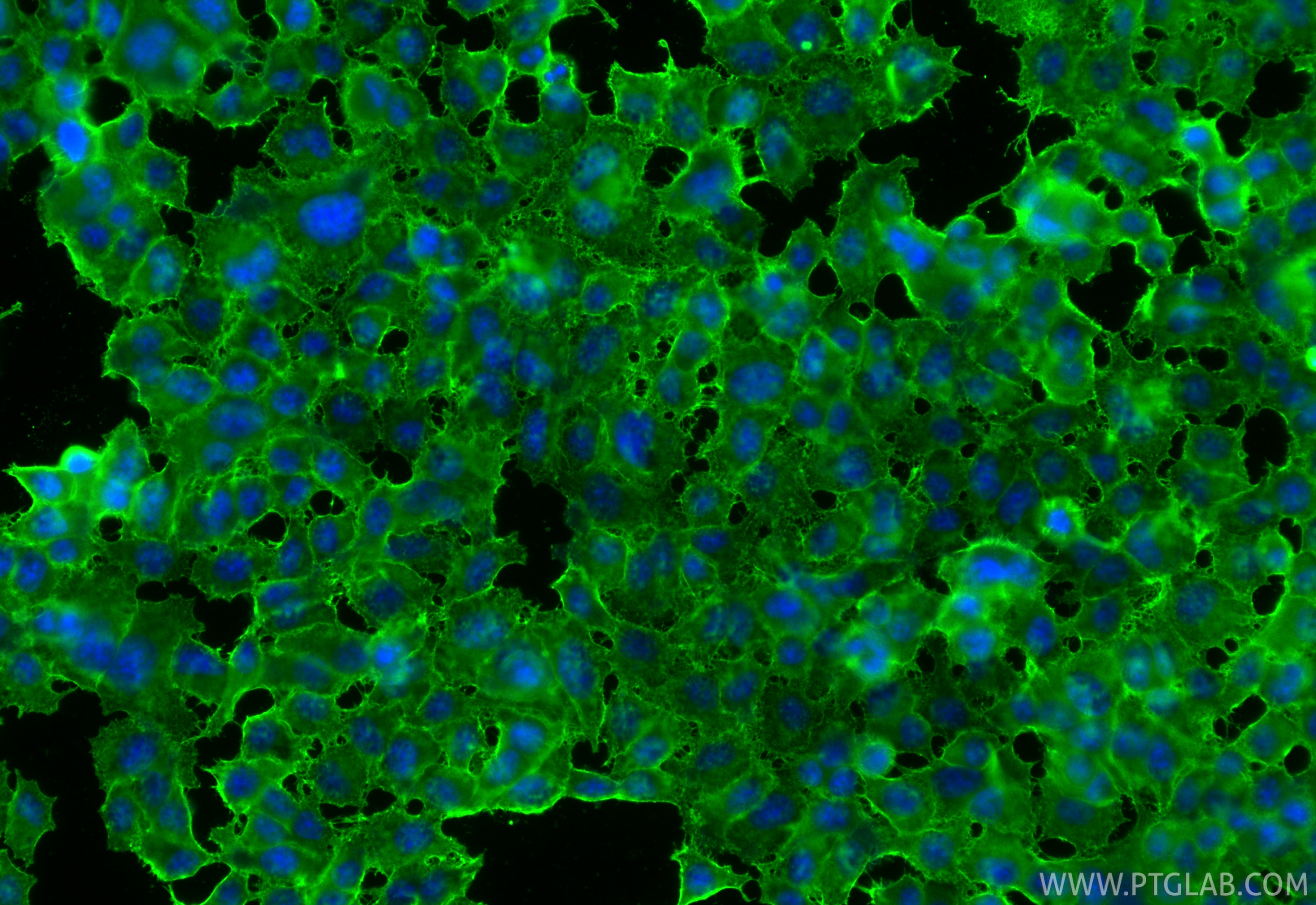 Immunofluorescence (IF) / fluorescent staining of PC-12 cells using Multi-rAb® SNAP25 Multi-Recombinant antibody (RMX00106)