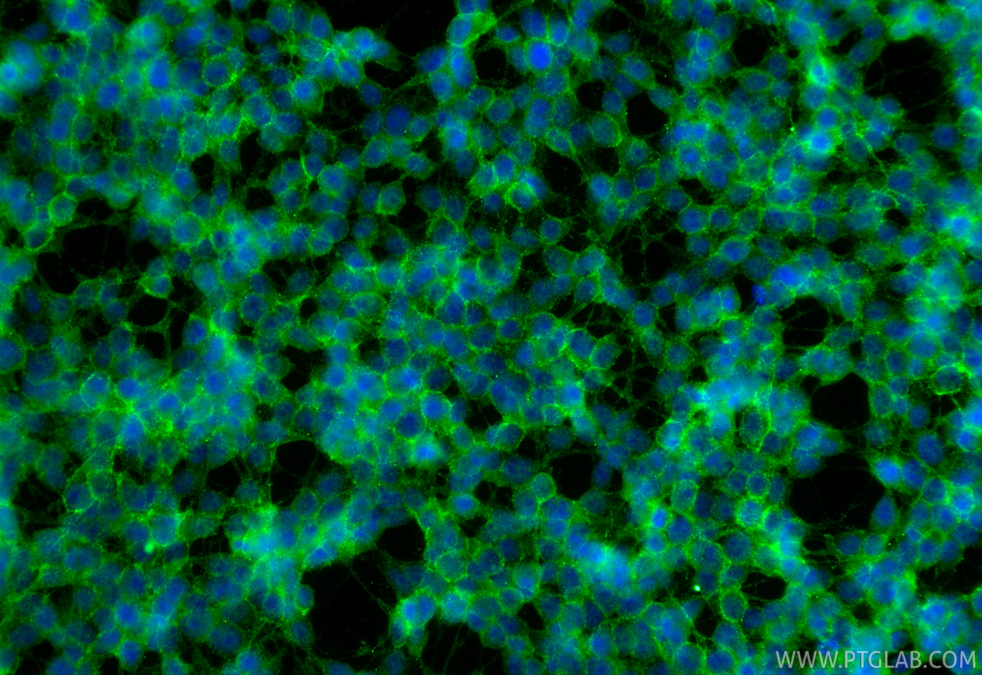 Immunofluorescence (IF) / fluorescent staining of SH-SY5Y cells using Multi-rAb® SNAP25 Multi-Recombinant antibody (RMX00106)