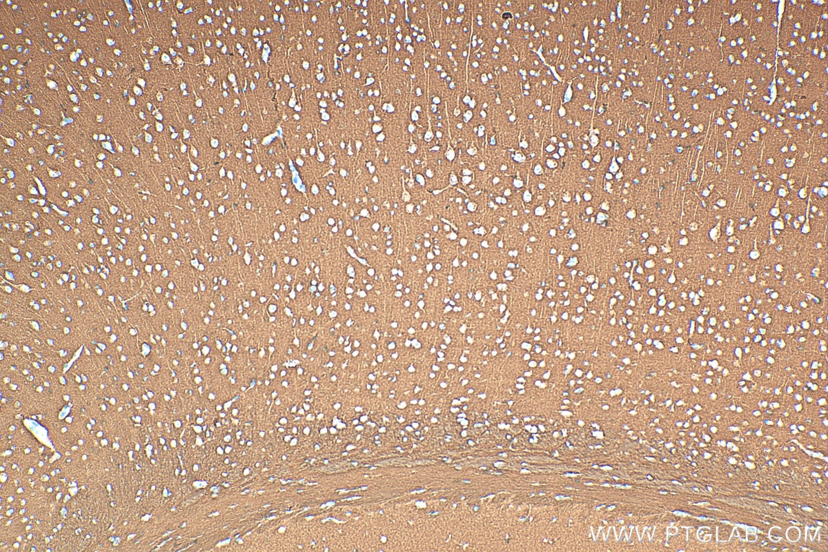 Immunohistochemistry (IHC) staining of mouse brain tissue using Multi-rAb® SNAP25 Multi-Recombinant antibody (RMX00106)