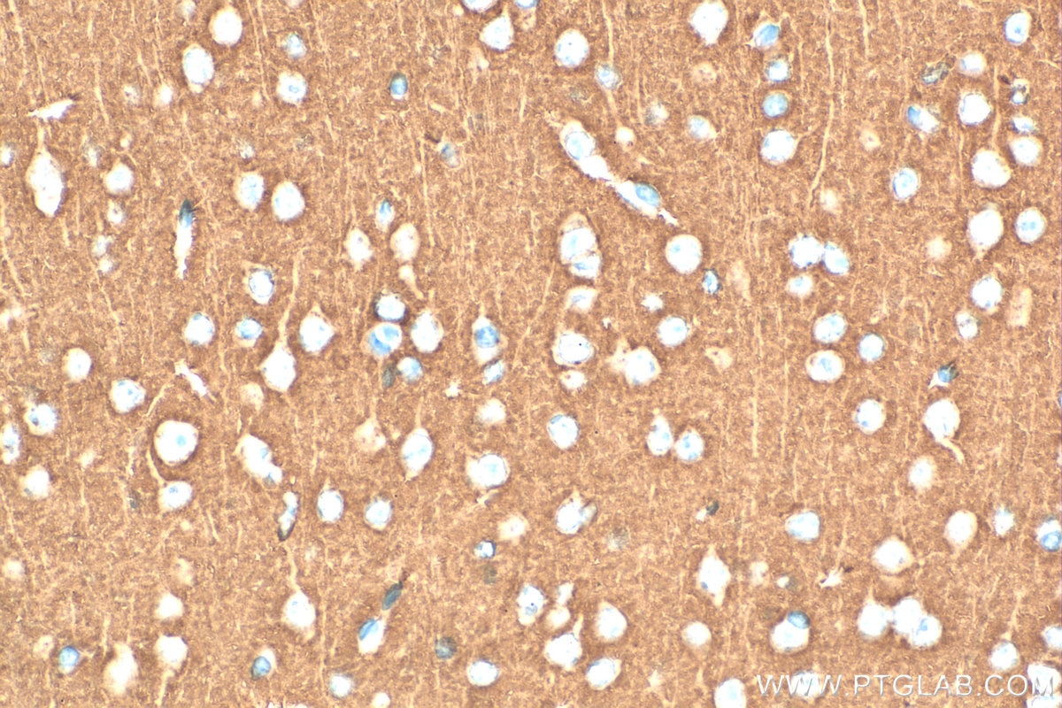 Immunohistochemistry (IHC) staining of mouse brain tissue using Multi-rAb® SNAP25 Multi-Recombinant antibody (RMX00106)