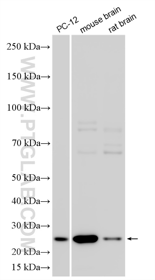 Western Blot (WB) analysis of various lysates using Multi-rAb® SNAP25 Multi-Recombinant antibody (RMX00106)
