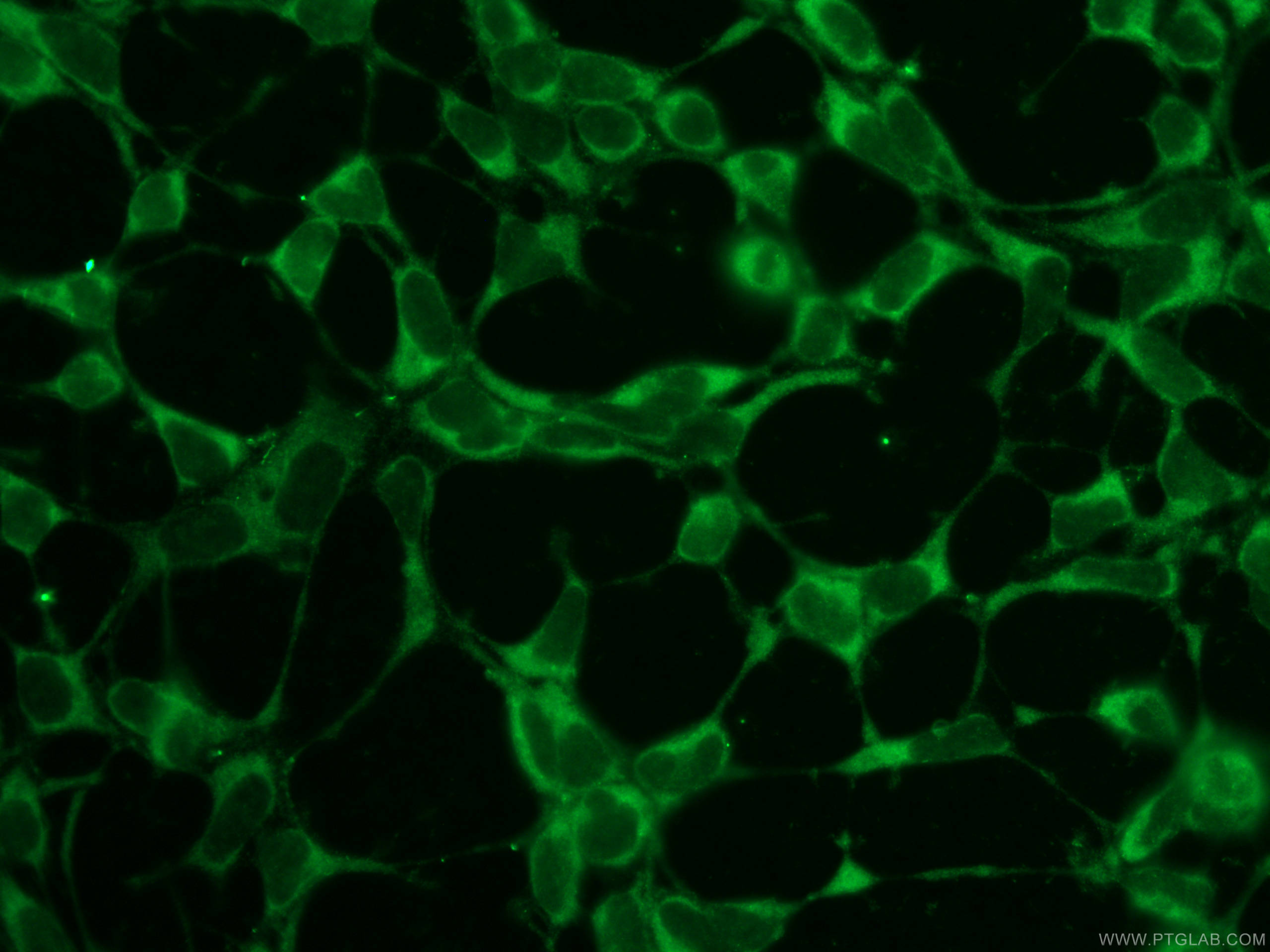 Immunofluorescence (IF) / fluorescent staining of HEK-293 cells using SNAP29 Polyclonal antibody (12704-1-AP)